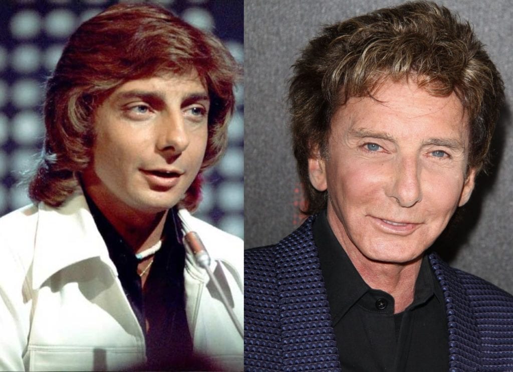 Barry Manilow 1 - most expensive celebrity plastic surgeries