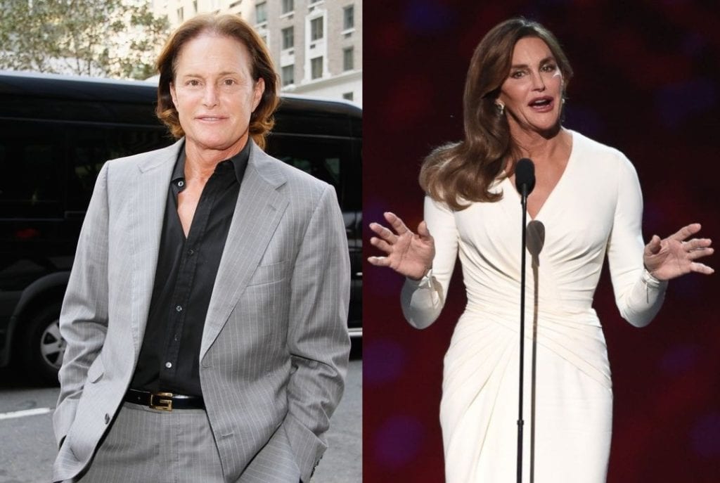 Bruce and Caitlyn Jenner - most expensive celebrity plastic surgeries