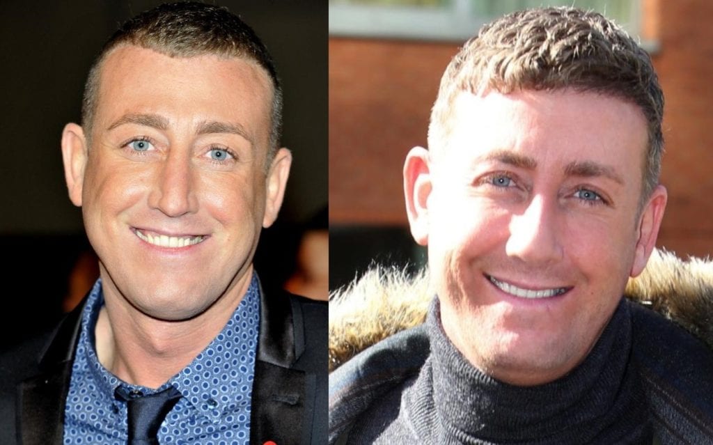 Christopher Maloney 1 - most expensive celebrity plastic surgeries