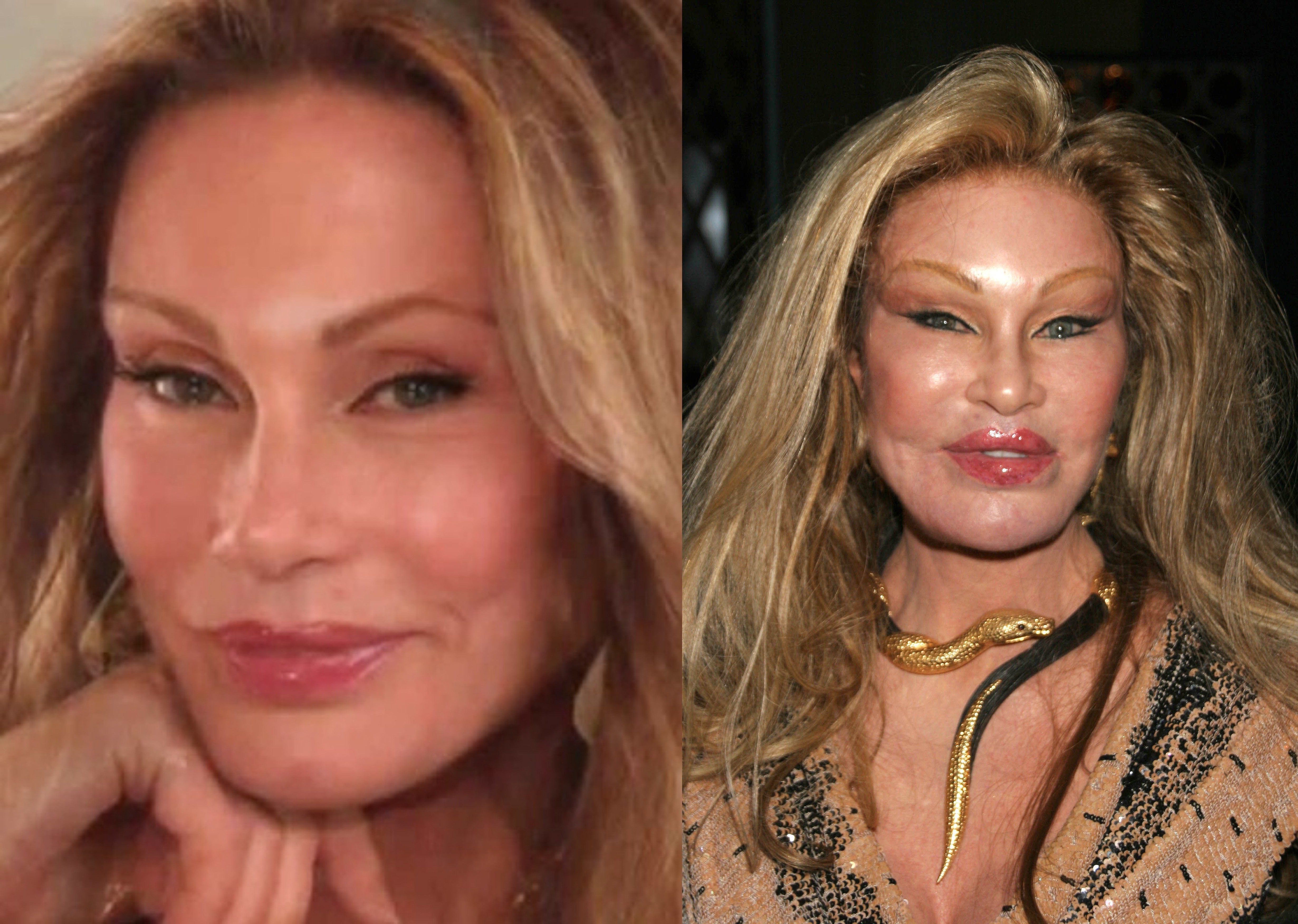 Jocelyn Wildenstein Before