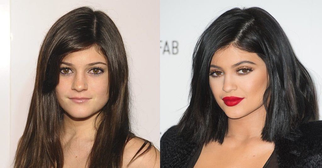 Kylie Jenner Most Expensive Celebrity Plastic Surgeries