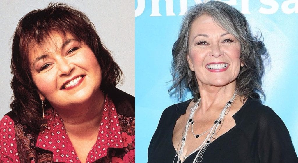 Roseanne Barr 2 - most expensive celebrity plastic surgeries